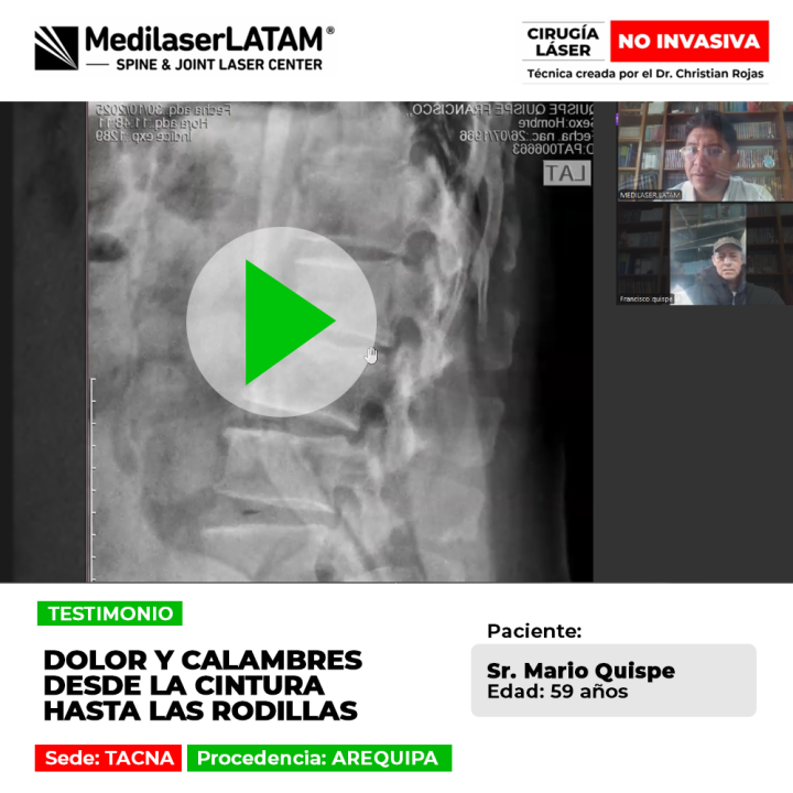 El dolor y calambres continuos en las extremidades inferiores afectan gravemente la marcha. Descubre cómo lograr su alivio.