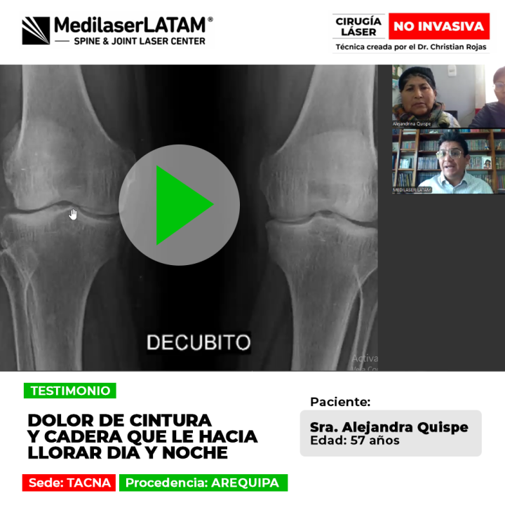 El dolor de cintura y cadera intenso altera la calidad de vida. Infórmate sobre el tratamiento médico para superar este malestar.