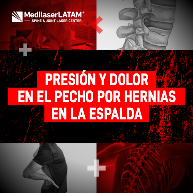 Las hernias en espalda pueden causar opresión torácica y malestar severo. Conoce la relación entre la columna y estos síntomas.