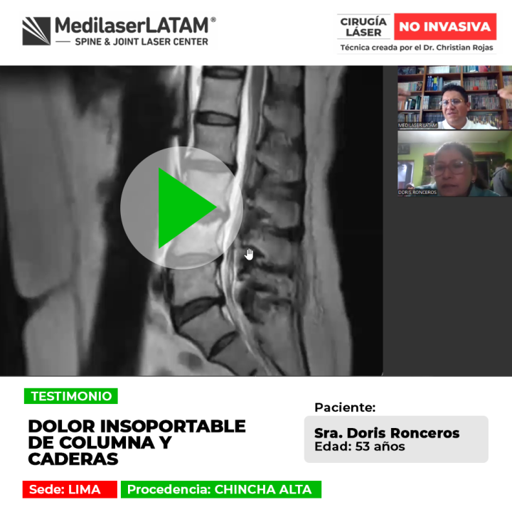 Un dolor de columna agudo en la zona lumbar afecta la estabilidad corporal. Consulta soluciones médicas para este padecimiento.