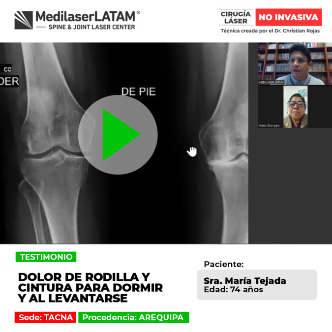 Dolor de rodilla y cintura al dormir: infórmate sobre sus causas principales y cómo tratar esta molestia al levantarse.