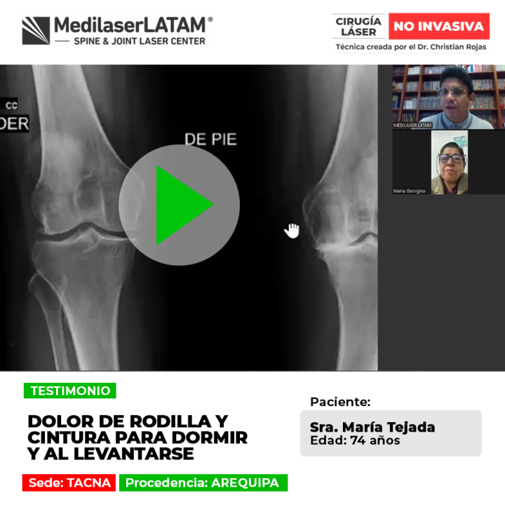 Dolor de rodilla y cintura al dormir: infórmate sobre sus causas principales y cómo tratar esta molestia al levantarse.