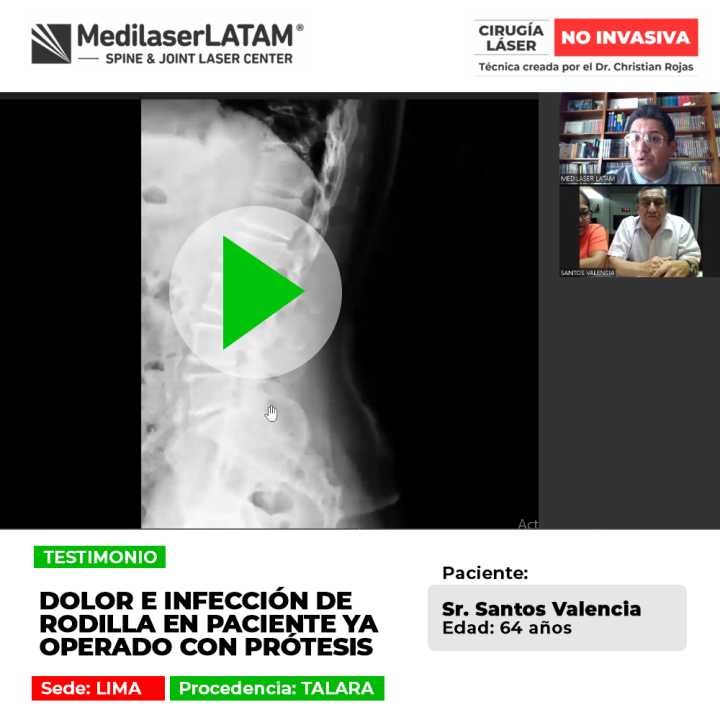 Infección de prótesis de rodilla: conoce las causas de este dolor posoperatorio y cómo debe abordarse médicamente.