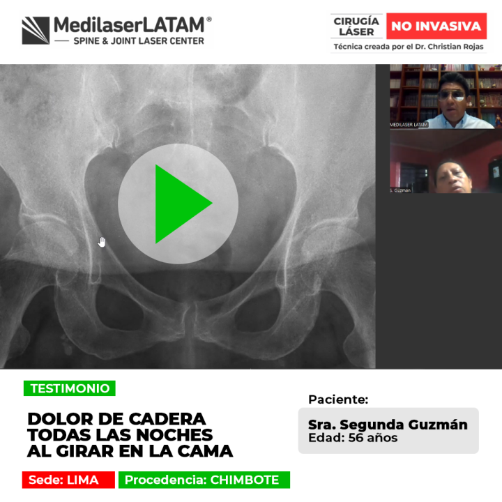 El dolor de cadera nocturno interrumpe el descanso y la movilidad en cama. Descubre procedimientos médicos para lograr mejoría.