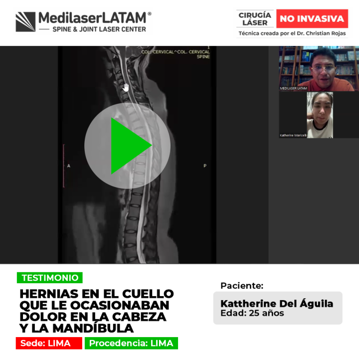 Las hernias en cuello provocan dolores irradiados hacia la cabeza y la mandíbula. Conoce soluciones médicas para calmar el malestar.