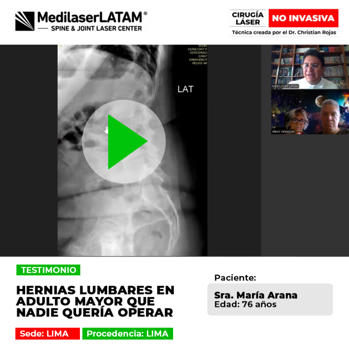 Las hernias lumbares en adultos mayores pueden tratarse sin cirugías riesgosas. Conoce alternativas médicas seguras para su bienestar.